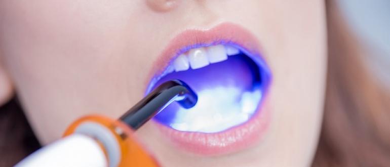 Стираемость зубов — патологическая и физиологическая Сточились передние зубы